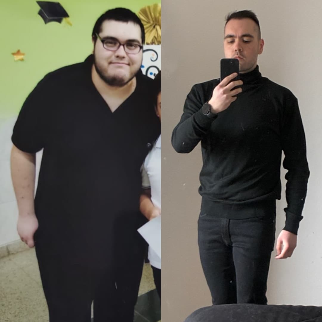 Jonathan Montenegro antes y ahora: a la izquierda a 144 kilos, a la derecha después de bajar.